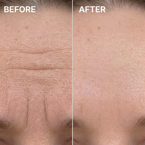 PDRN Pink Collagen Volume Multi Balm